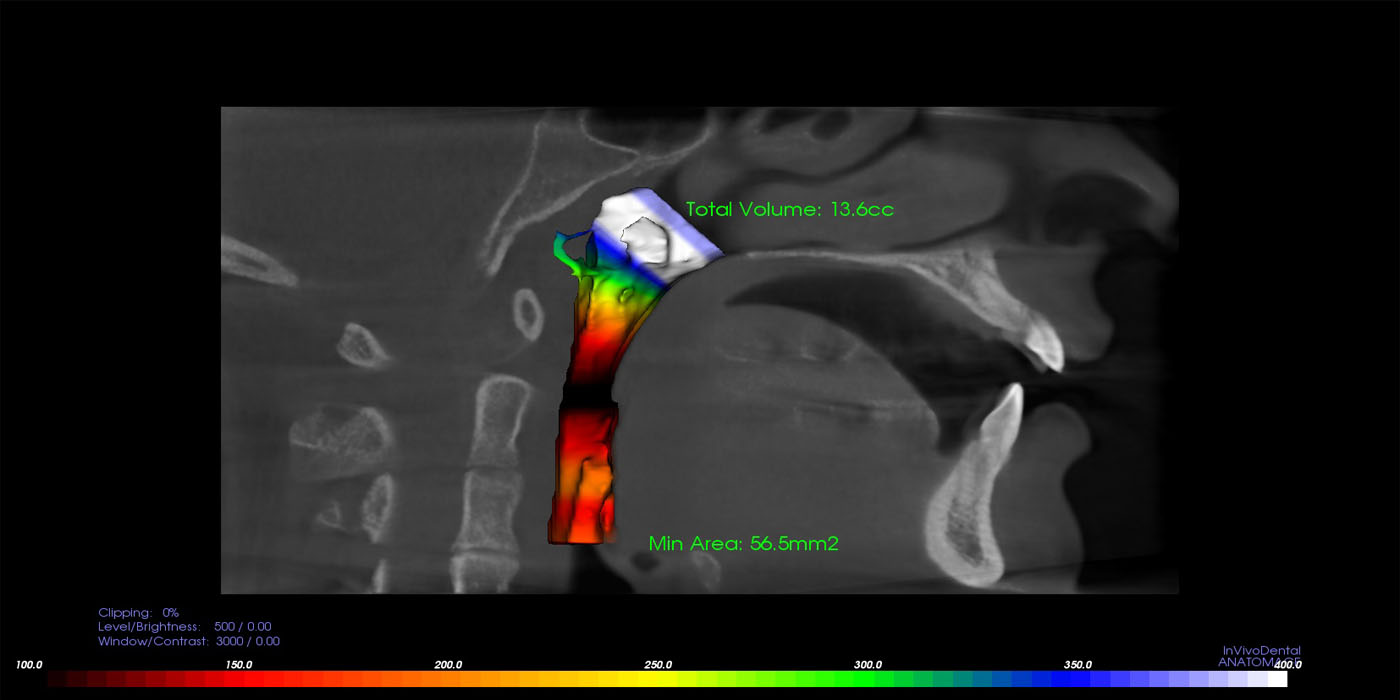 Airway Scan 